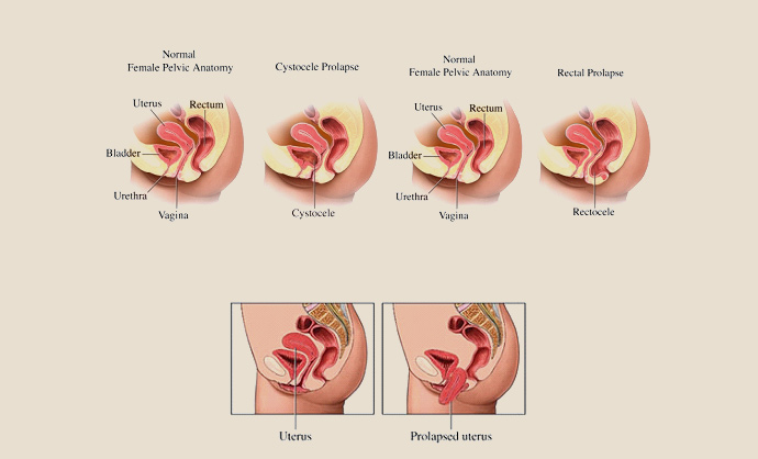 Exclusive Women’s Healthcare | Gynecology